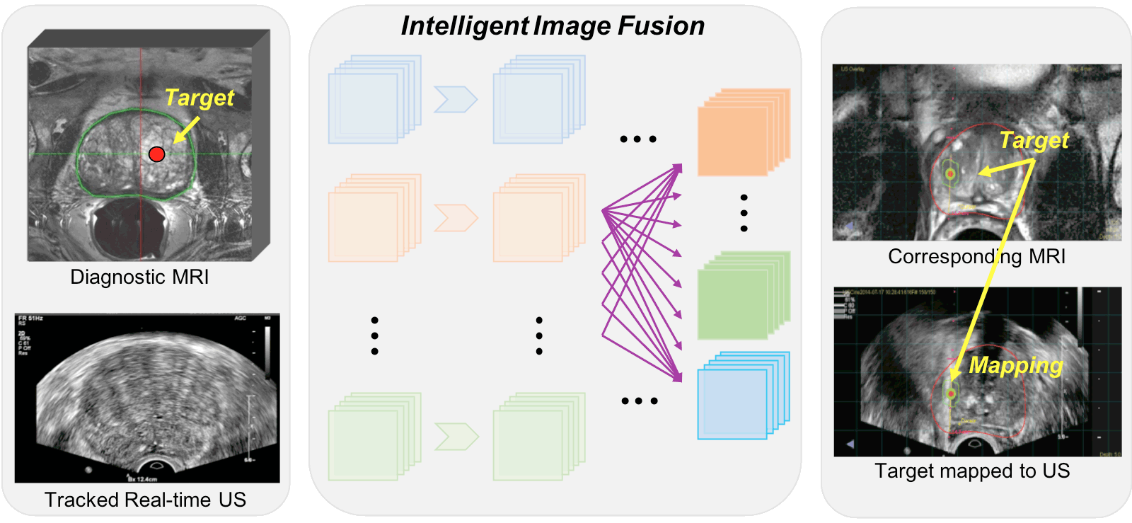 Intelligent Image Fusion