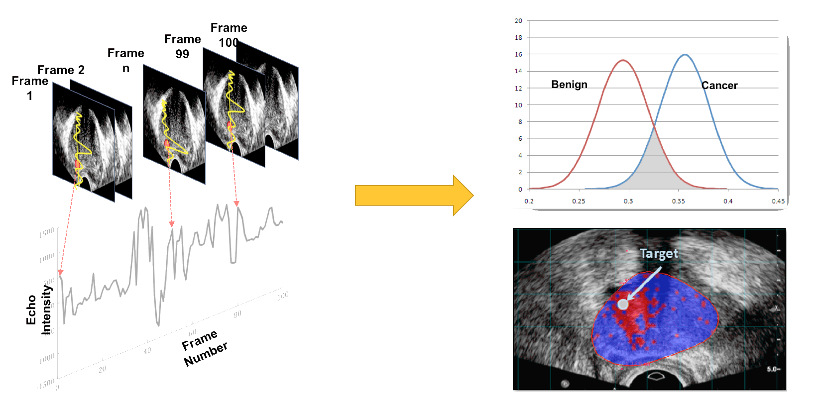 Temporal Enhanced Ultrasound